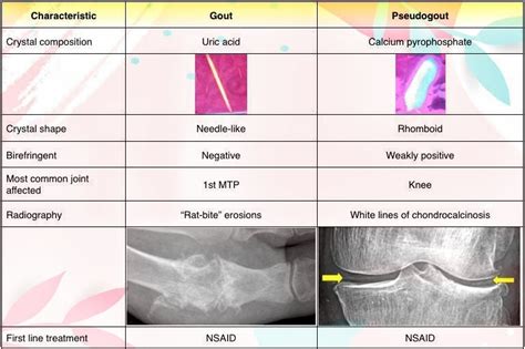 Difference Between Gout and Pseudogout