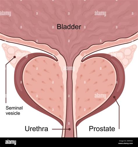Medical diagram of healthy prostate with bladder. vector illustration ...