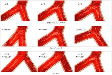 Modeling and Visual Simulation of Bifurcation Aneurysms Using Smoothed ...
