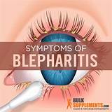 Blepharitis Symptoms, Causes & Treatment