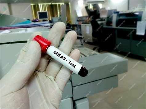 Premium Photo | Blood sample for dheas or dehydroepiandrosterone sulfate hormone test