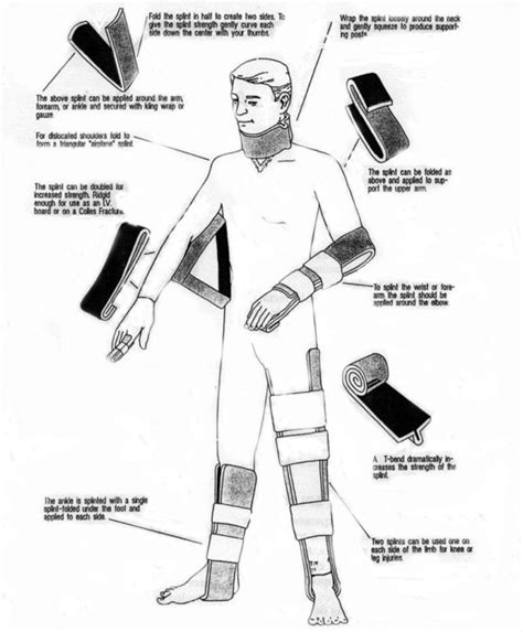 Image result for Sam Splint