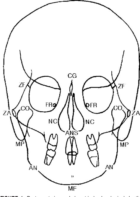 Image result for Contralateral Head Rotation