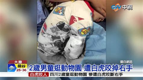【中視新聞】2歲男童逛動物園 遭白虎咬掉右手 20150705 - YouTube