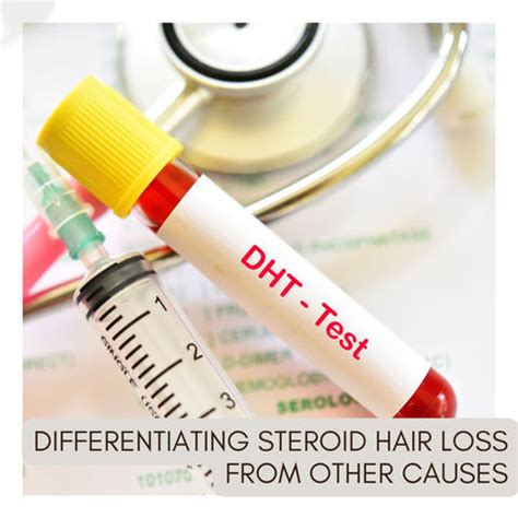 Steroids and Hair Loss: Understanding the Connection | Clinikally