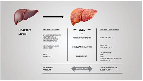 Dental Management Of Patients With End-Stage Liver Disease at Eula Seay blog