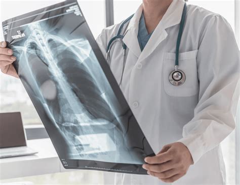 Image result for Thoracotomy Approach