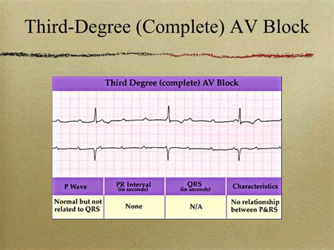 Image result for ACLS Code Blue Algorithm