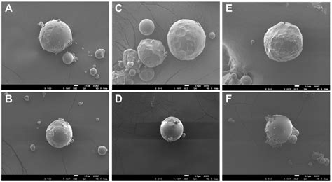 Sustained-Release Microspheres of Rivoceranib for the Treatment of ...