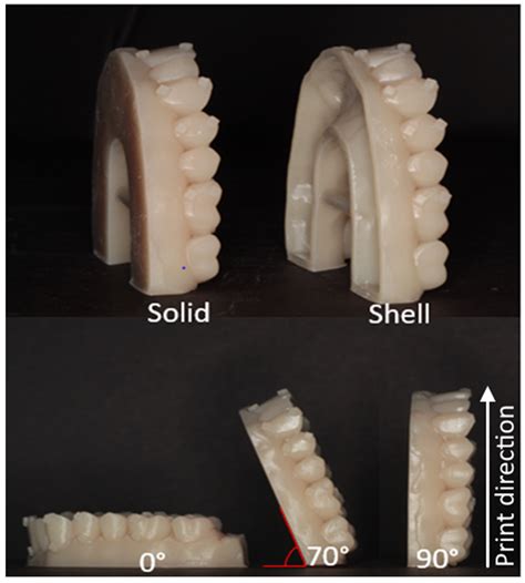 Effect of Model Body Type and Print Angle on the Accuracy of 3D-Printed ...