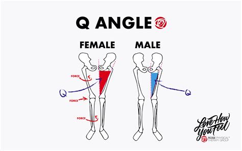 Q Angle Knee