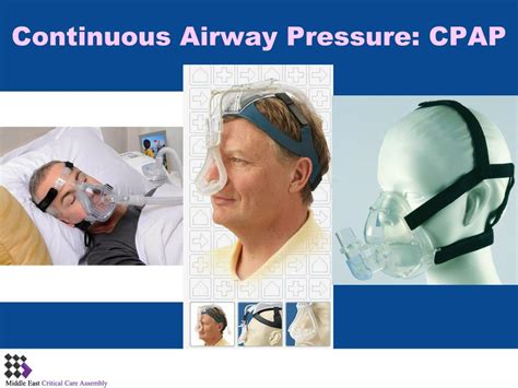 Image result for PaO2/FiO2 Equation