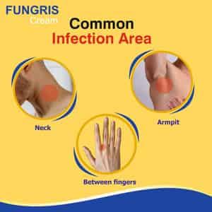 Buy FUNGRIS CLOTRIMAZOLE 1 % ANTI FUNGAL DUSTING POWDER 100 GMS PACK OF ...