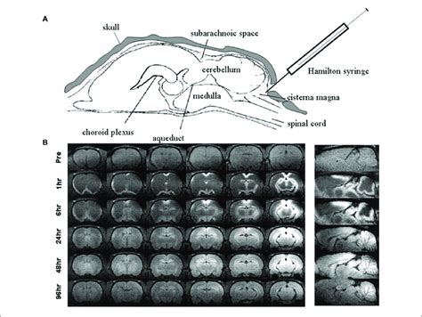 Image result for Intrathecal Injection Mouse