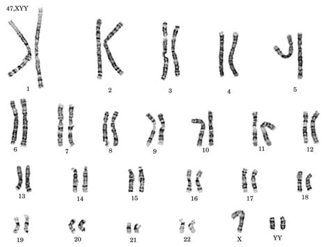 PPT - Chromosomal Variations PowerPoint Presentation - ID:567181