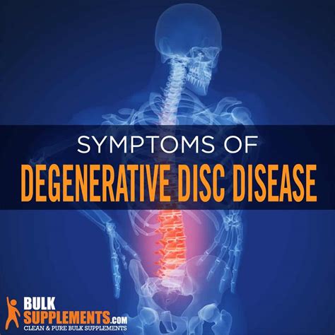 Lumbar Disc Disease Vs Degenerative Disc Disease at Victoria Brownlee blog