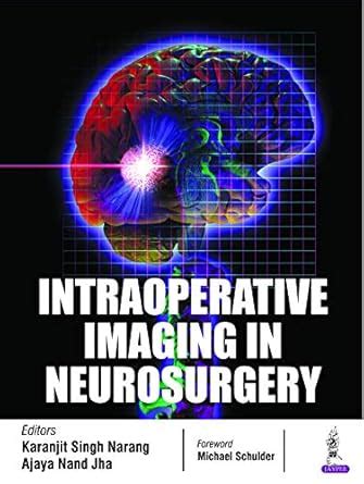 Intraoperative Imaging in Neurosurgery eBook : Narang, Karanjit Singh ...