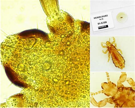 Image result for Magnification Examples