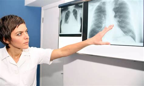 Pulmonary veno-occlusive disease in Sjogren's syndrome: a case report