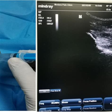 Image result for Injection Practice