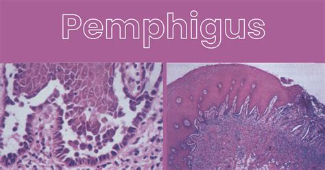 Dental Topics - Dental Edge