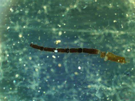 Image result for Microscope Toes