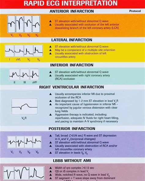 Ecg Reading Normal And Abnormal
