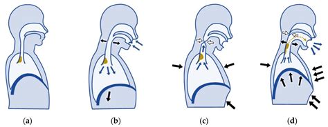 Clinical Significance of Cough Peak Flow and Its Non-Contact Measurement via Cough Sounds: A ...