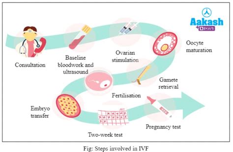IVF Procedure Explained 的图像结果