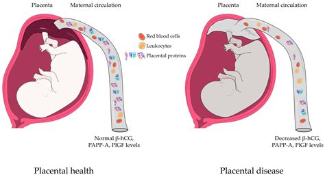 Decreased Expression of Placental Proteins in Recurrent Pregnancy Loss ...