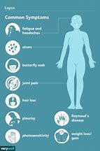 Image result for Lupus Symptoms