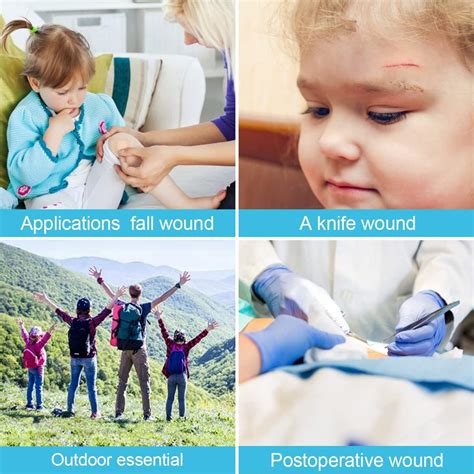 Buy Zip Stitch Sutures Butterfly Bandaids - 2 Pcs Zipstitch Laceration ...