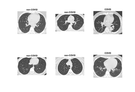 CT Scan Example 的图像结果