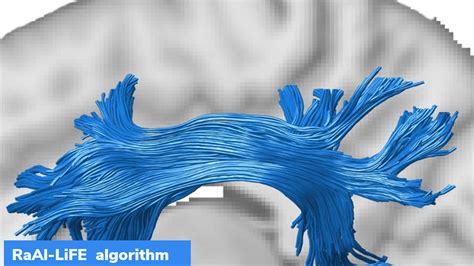 IISc: New algorithm to study brain connectivity – GKToday