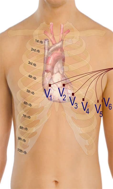 ECG - App on Amazon Appstore
