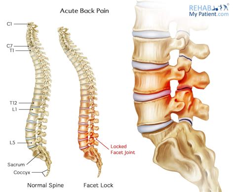 Lumbar Spine Nerve Chartlower Back Pain Diagram
