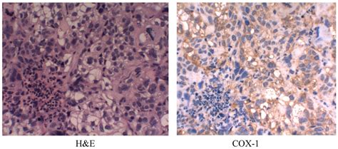 Effects of SC-560 in Combination with Cisplatin or Taxol on ...