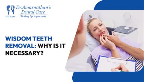 Image result for Remove Wisdom Teeth