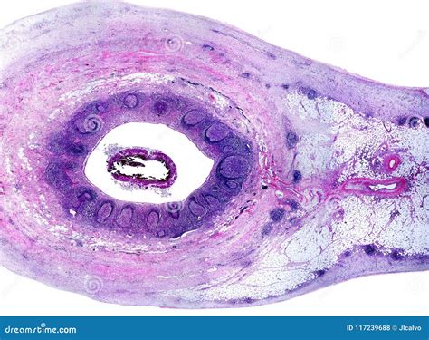 Image result for Appendix Labeled