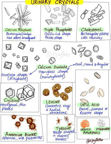 Amorphous Phosphate Crystals In Urine