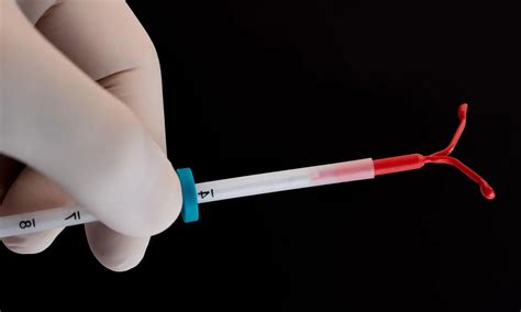 NEJM Study compares contraceptive efficacy and side effects of Mini ...