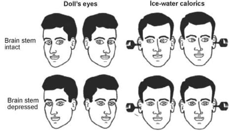 Cranial nerve examination | PPTX