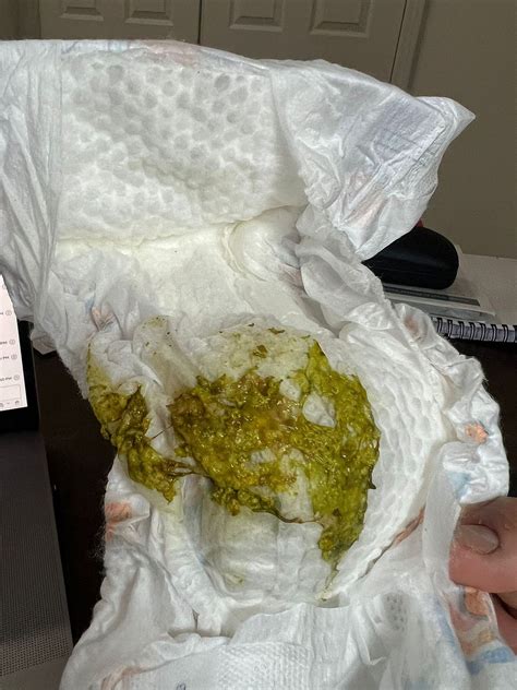 Newborn Girl Blood In Diaper at Tamara Juarez blog