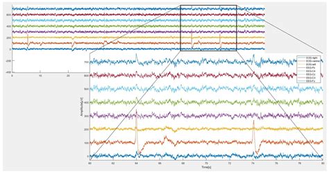 EEG Signal Complexity Measurements to Enhance BCI-Based Stroke Patients ...