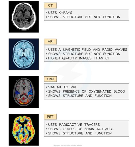 Techniques to Investigate the Brain | Edexcel International A Level ...