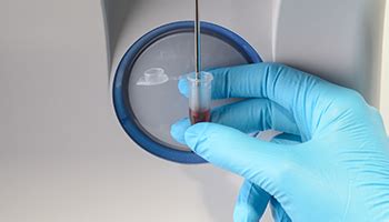 3-Part Differential Hematology Analyzer - BC-30s - Mindray India