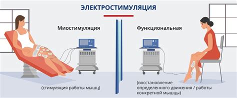 Механотерапия: аппараты и приборы для функциональной электростимуляции