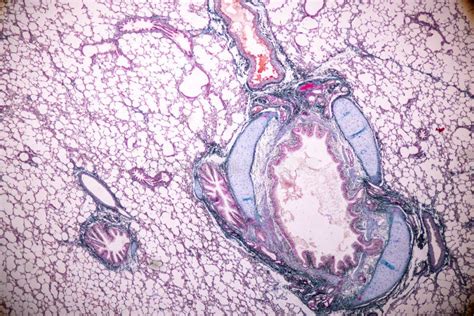 Image result for Tissue Sample Drawing Under Microscope