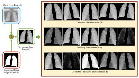 Drug-Resistant Tuberculosis Treatment Recommendation, and Multi-Class Tuberculosis Detection and ...