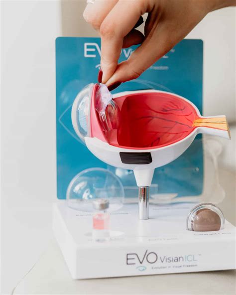 ICL Surgery Guide: Review, Procedure & Side Effects | ADARAS